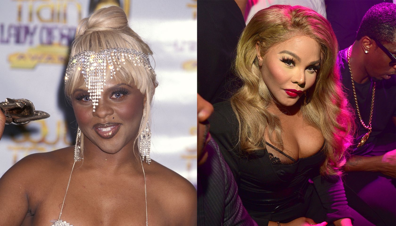 Lil Kim Plastic Surgery