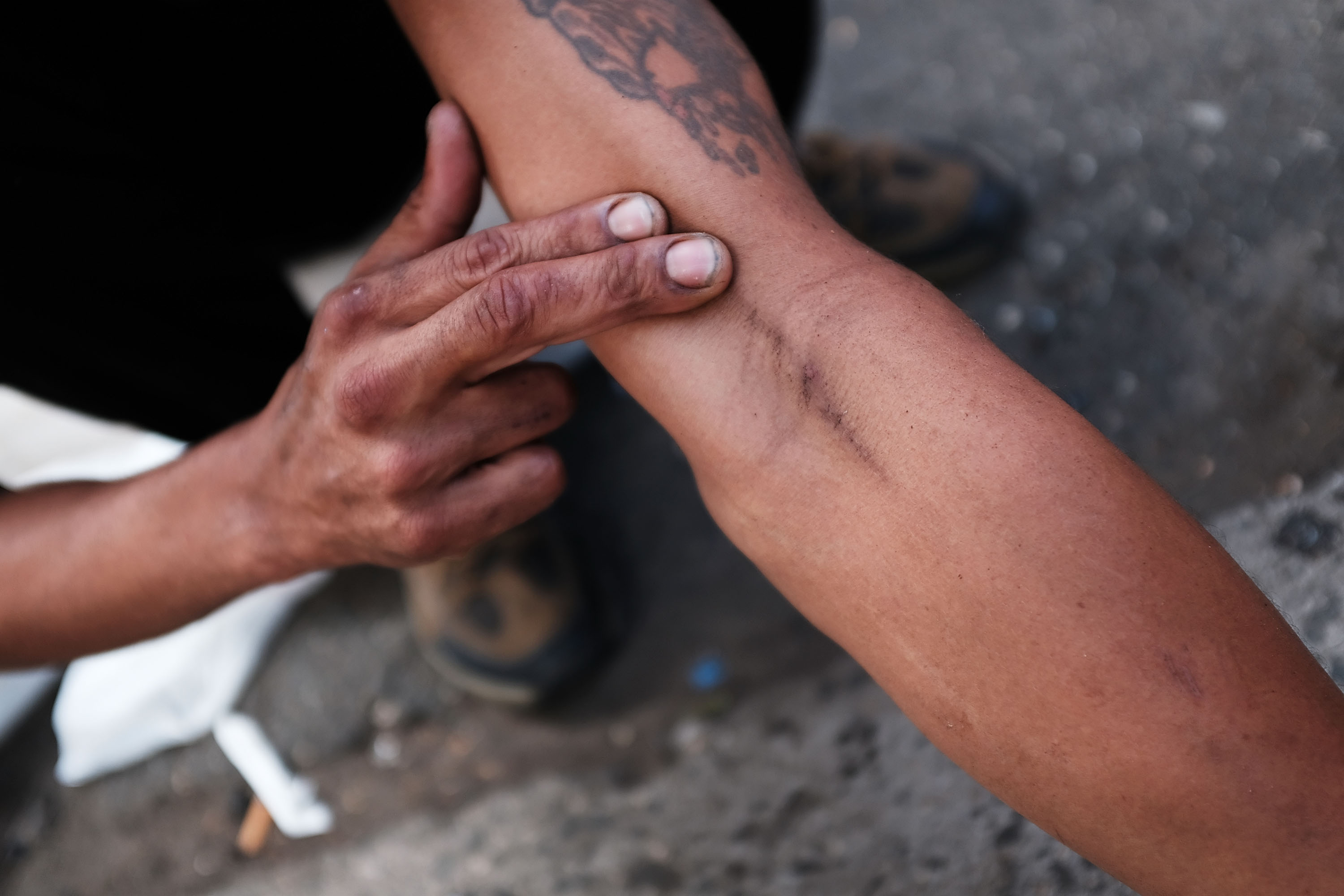 Opioid Epidemic Plagues Section Of Bronx Neighborhood