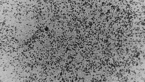 Scientists First To Grow Wuhan Coronavirus